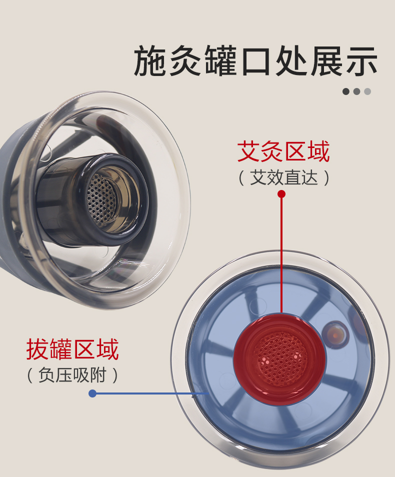 威阳拔罐艾灸结合方案(图4) 威阳拔罐艾灸结合方案(图4)